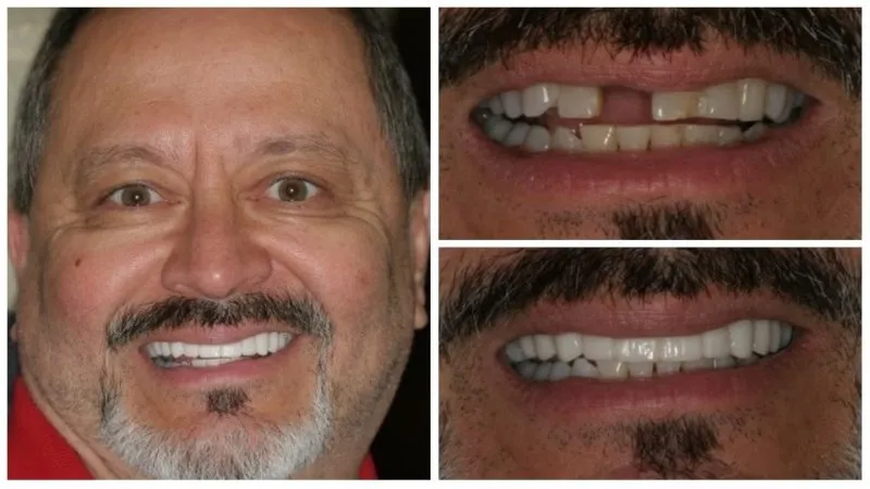 joe's smile transformation