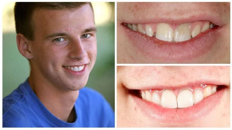 jackson's smile transformation
