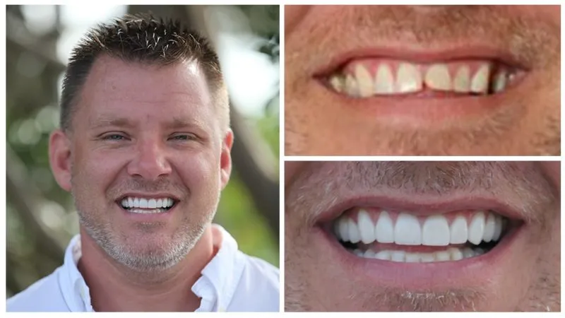 jason's smile transformation