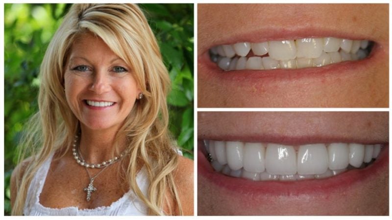 missy's smile transformation