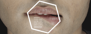 Closeup of man biting his dry chapped lips.