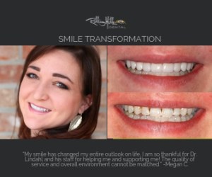 Megan C. Smile Transformation by Dr. Marty W. Lindahl graphic