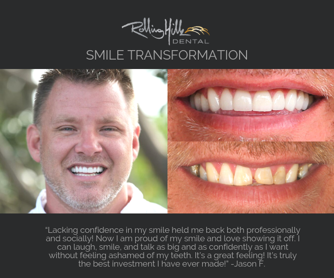 Jason F. Smile Transformation by Dr. Marty W. Lindahl graphic