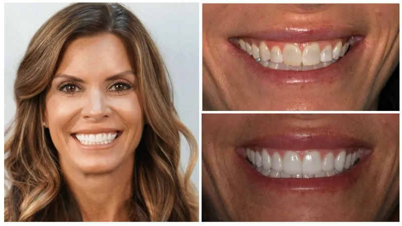 kristy's smile transformation