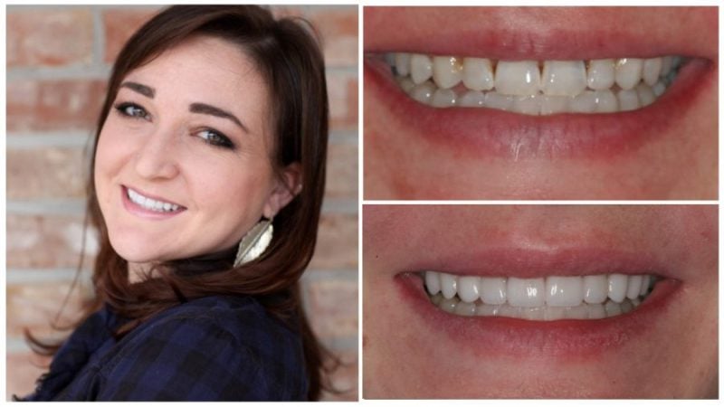 megan's smile transformation