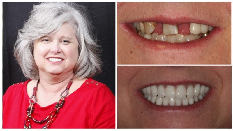 patty's smile transformation
